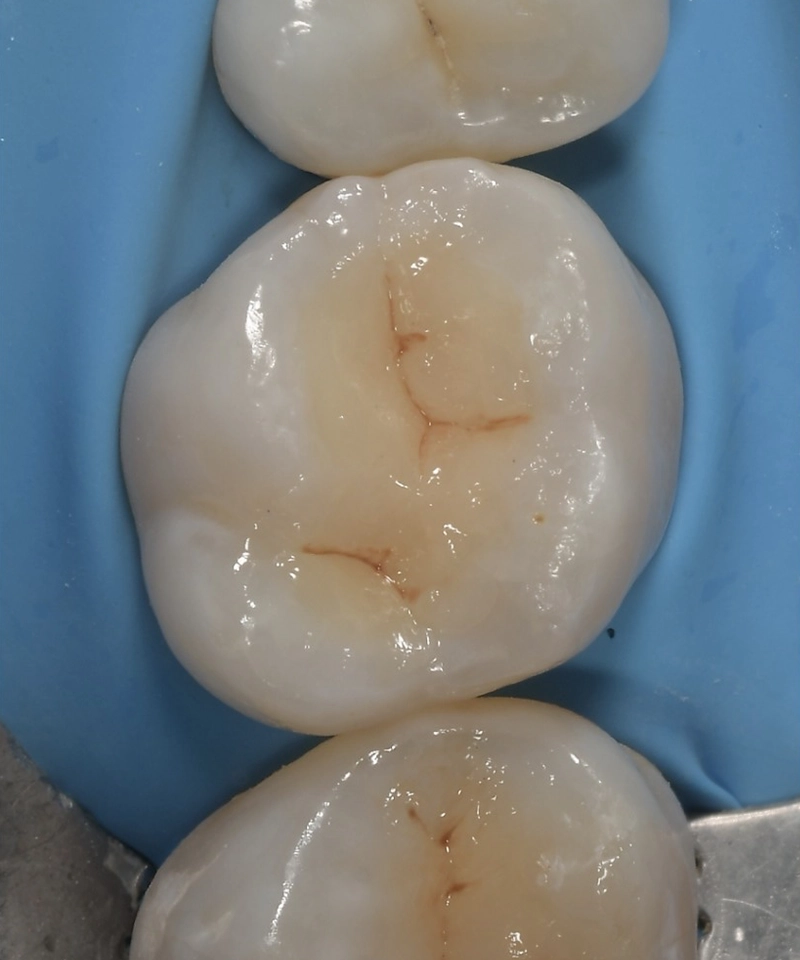 Odontoiatria conservativa endodonzia - Poliambulatorio Magellano