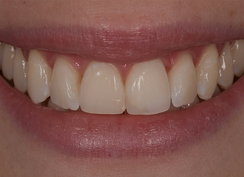 Odontoiatria Estetica Brescia - Poliambulatorio Magellano - Cosa facciamo